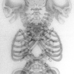 Bones A