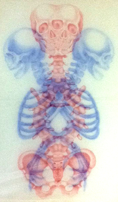 Bones A