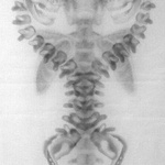 Bones B