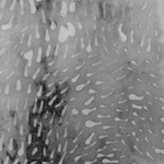 Negative Gearing (Detail)