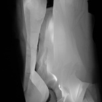 Crevice Light