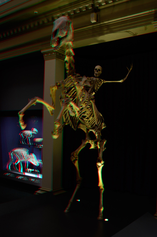 Bones