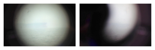 Coin Slot Telescope
