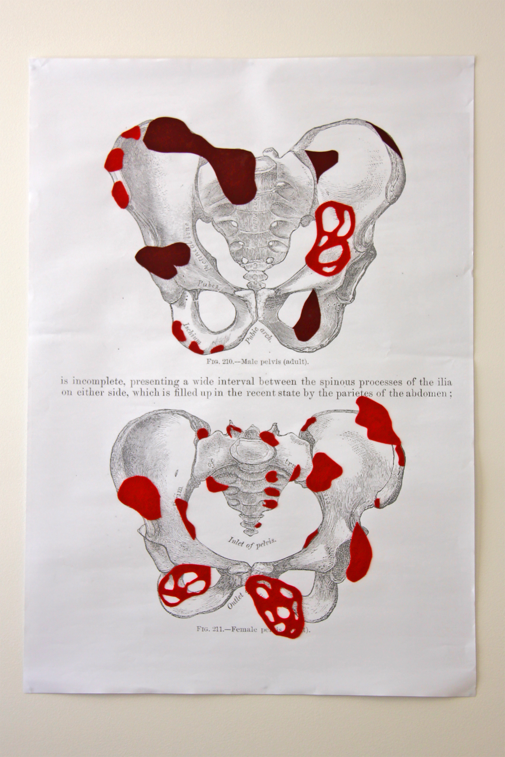 Pelvis Detail
